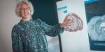 Anita Fosterud Reitan står foran en skjem og viser et fargerikt CT-bilde av en hjerne.